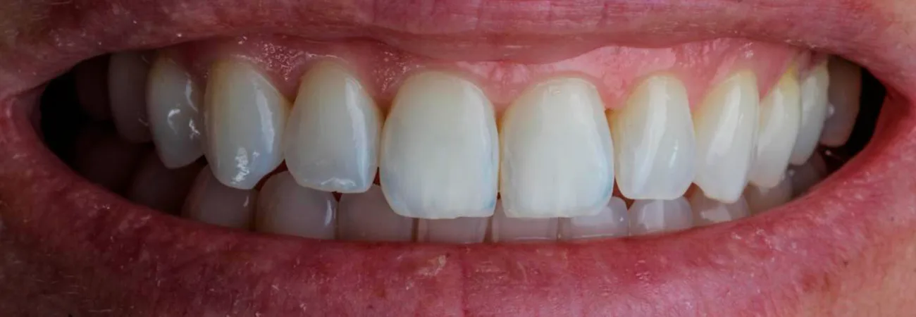 Periodontia