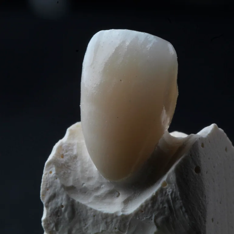 Tratamento com prótese dentária
