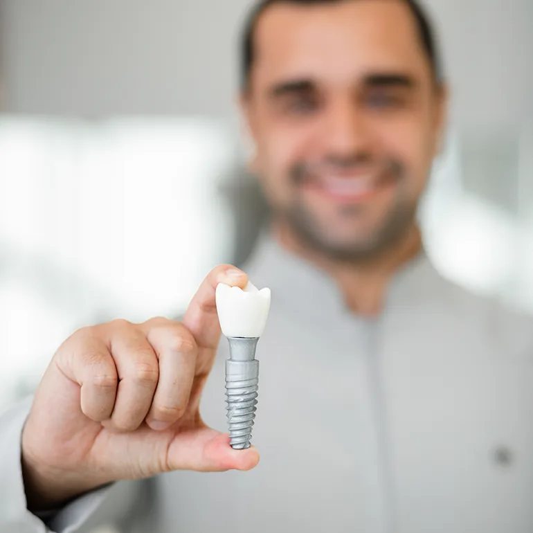Implantes Dentários