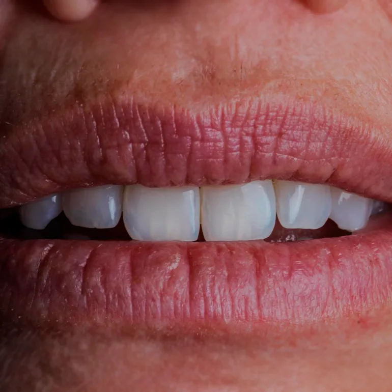 Periodontia