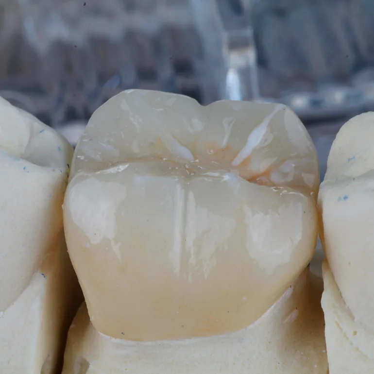 Prótese Dentária